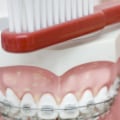 Do orthodontists insert implants?