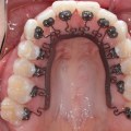 What do orthodontists do other than braces?