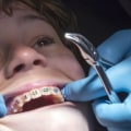 Should i go to a dentist or orthodontist for invisalign?